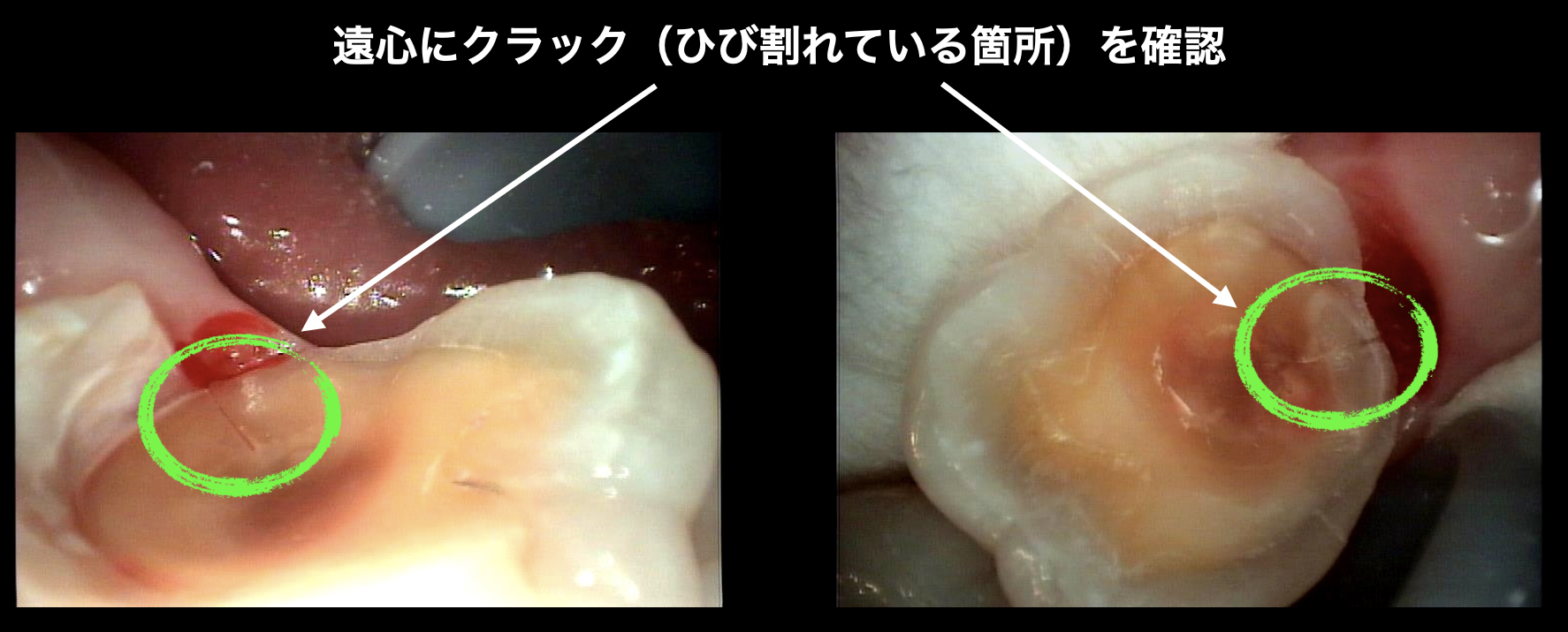 初診時