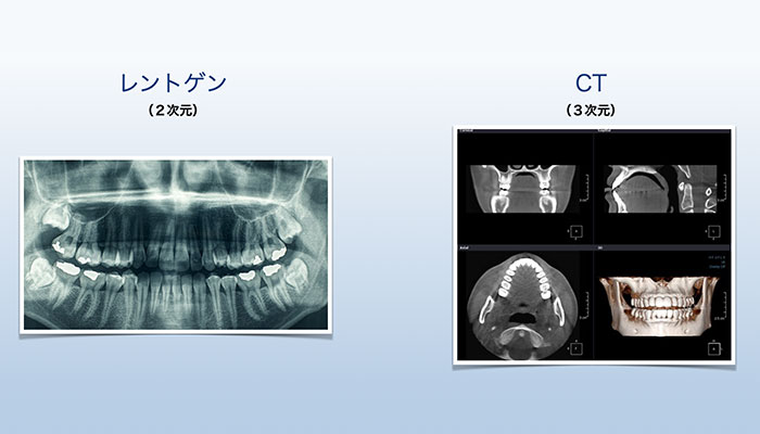 デジタル歯科用CTによる診査・診断