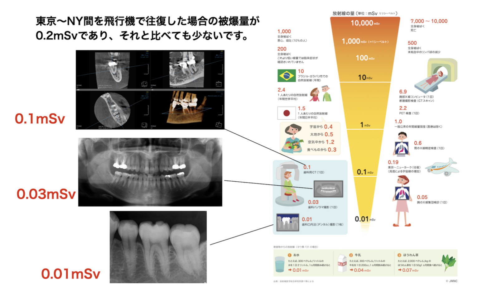 妊婦さんでも問題なく、レントゲン撮影が可能